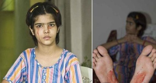 一滴雨可奪命！那些罕見的怪病