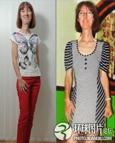 難以置信的罕見(jiàn)怪病：忘記呼吸 靜電過(guò)敏 聽鬧鐘響心臟停跳