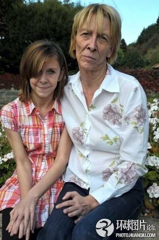 難以置信的罕見怪病：忘記呼吸 靜電過敏 聽鬧鐘響心臟停跳