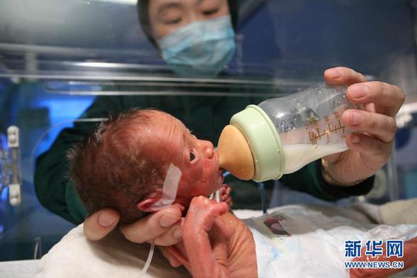 湖北襄陽一“袖珍女嬰”平安出院