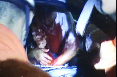 車禍中丈夫拒絕治療 爬回車內人工呼吸救妻子(圖)