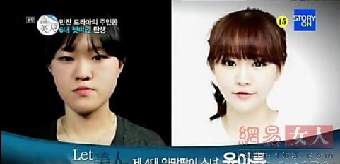 丑女變靚妹！韓國(guó)整容節(jié)目爆紅