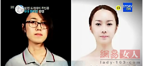 丑女變靚妹！韓國整容節(jié)目爆紅