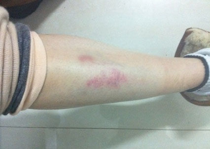 孫紅雷小沈陽(yáng)打架高峰斗歐 揭?jiàn)蕵?lè)圈打人事件(圖)