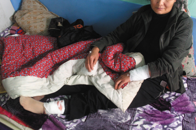 大連:藏獒掙脫鎖鏈 咬傷53歲保潔員