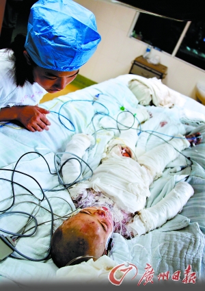 惡父多次開水燙七歲女兒續(xù) 父親或判2至7年(圖)