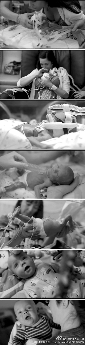 “你就是生命的奇跡！” 早產(chǎn)寶寶堅(jiān)強(qiáng)活下來(lái)