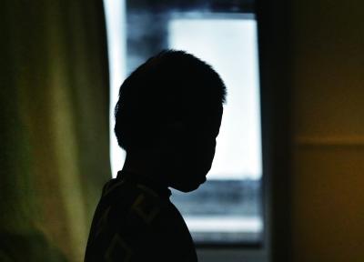 山西“面具娃娃”來京整容 不怕手術想“變漂亮”