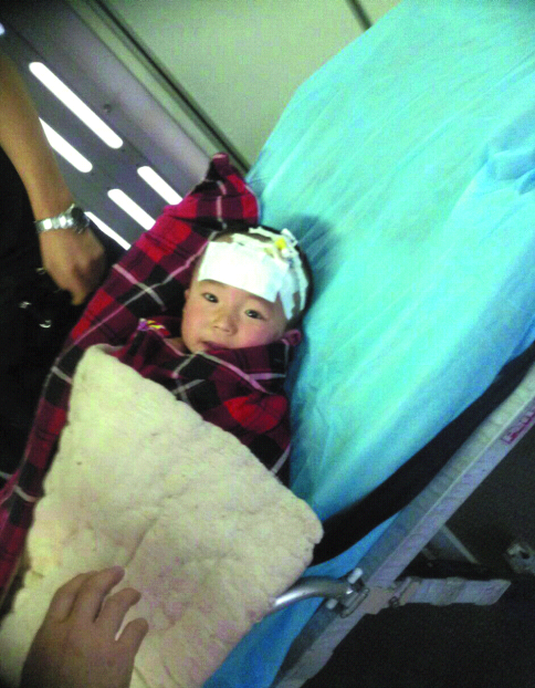 阿克蘇兩歲半男童掉進開水鍋