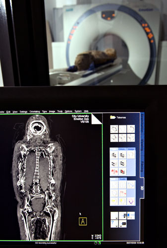 倫敦千年木乃伊X光“檢查身體”