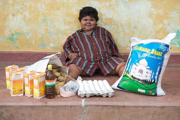 印度女孩5歲150斤醫生擔心活活吃死