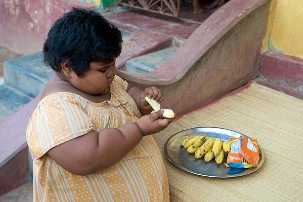 印度女孩5歲150斤醫生擔心活活吃死
