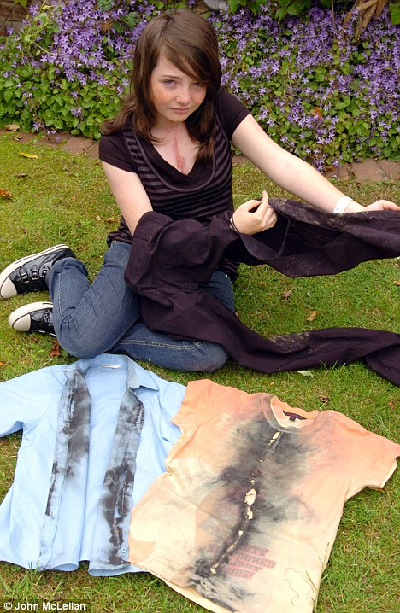 30萬伏高壓閃電擊中14歲女孩 iPod奇跡般救命