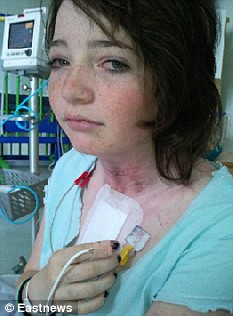 30萬伏高壓閃電擊中14歲女孩 iPod奇跡般救命