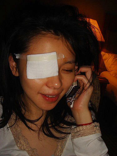 徐若瑄右眼包紗布變獨眼龍否認(rèn)被歌迷砸傷