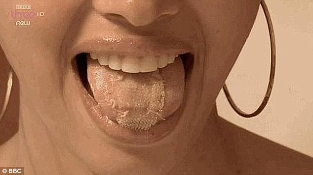 探訪委內瑞拉世界小姐訓練營：為減肥舌上縫塑料網（組圖）