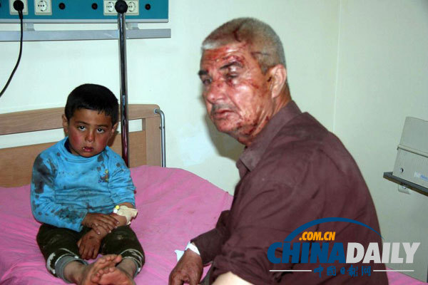 土耳其敘利亞邊界發生汽車爆炸致24人死亡