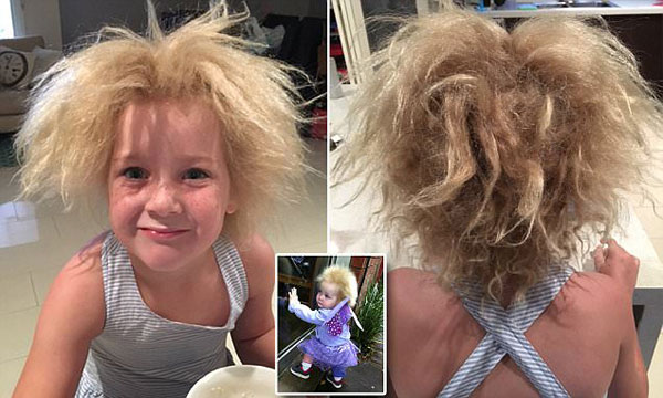 女孩患罕見“蓬發綜合征” 發型狂放不羈 酷似愛因斯坦