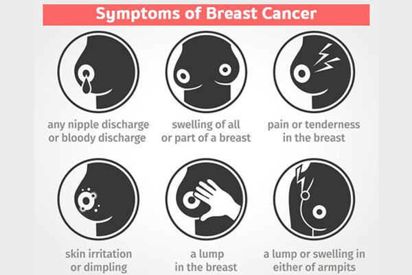 《副總統》女主患乳腺癌 這種“女性殺手”有哪些表現