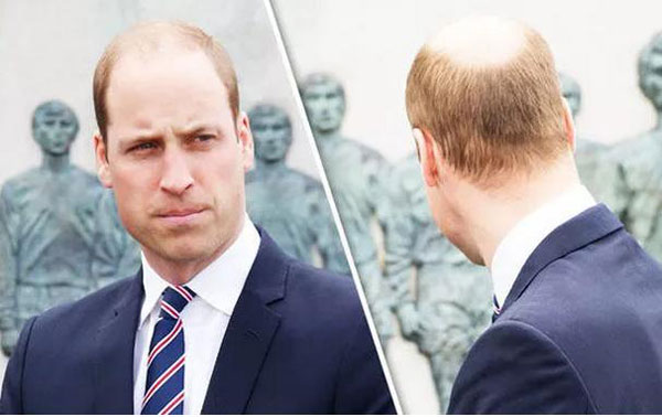 拿什么拯救90后的發際線？別急，科學家找到辦法啦