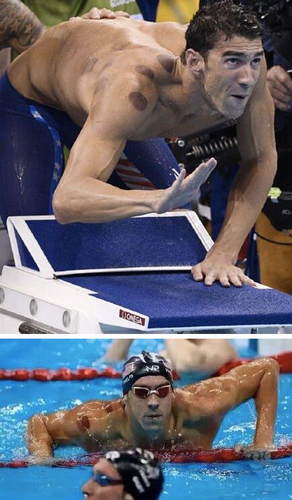 流感肆虐 中國神藥川貝枇杷膏在美國火了