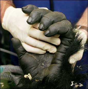 hand, breast cancer, gorilla