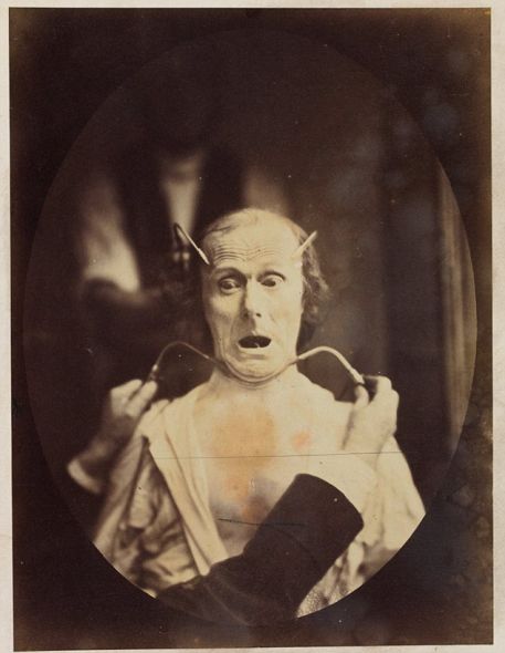 揭秘達爾文最后實驗:探索人類情緒表情扭曲